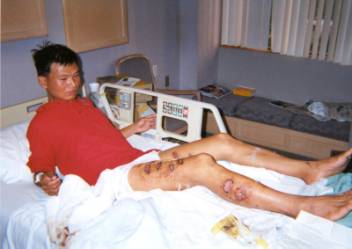 Tan Yongjie, 27-godišnji radnik i Falun Gong praktikant, izmučen i povrijeđen, putovao je tisuće kilometara u teretnom brodu, da bi pobjegao od progona u Kini.